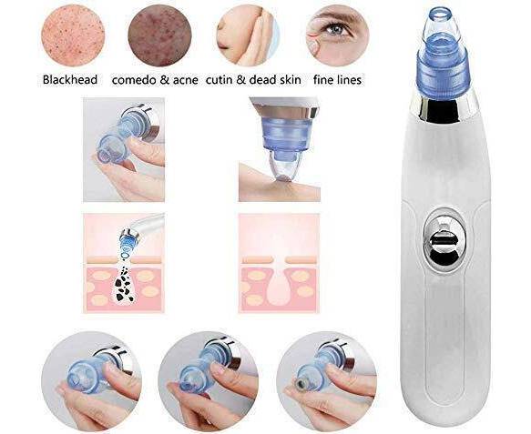 Blackhead Removal Machine | Acne Pimple Pore Cleaner Vacuum Suction Tool